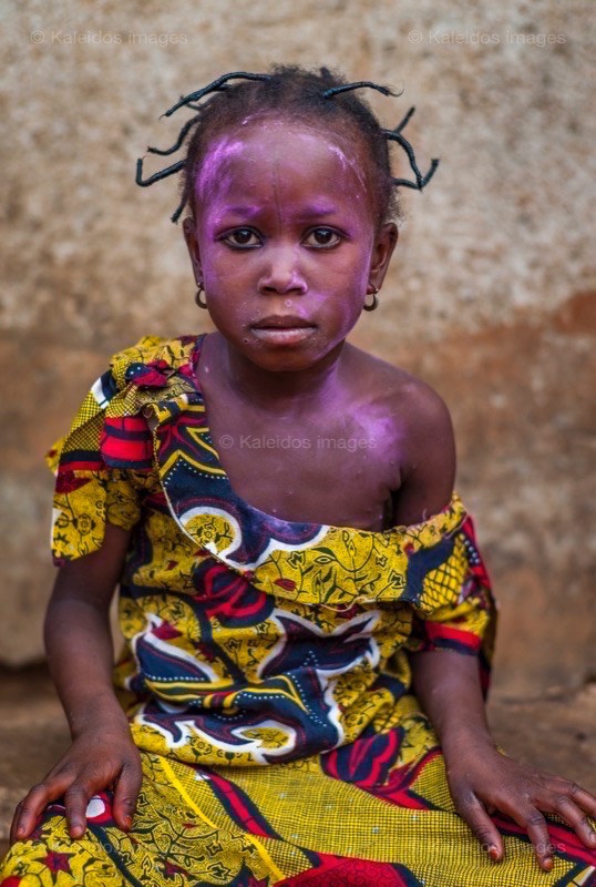 Africa;Benin;Chickenpox;Children;Girls;Kaleidos;Kaleidos images;La parole à l'image;Pink;Tarek Charara